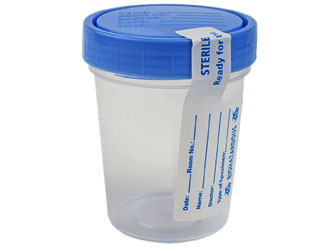 120  ml Sterile Urinalysis